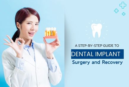 A Step-by-Step Guide to Dental Implant Surgery and Recovery
