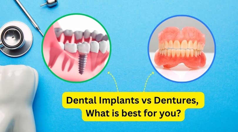Dental Implants vs. Dentures: What is Best for You?