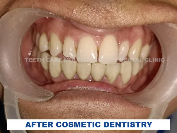 
                         after cosmetic dentistry 