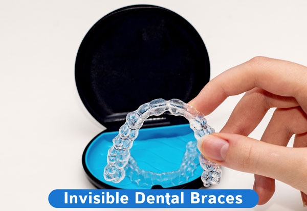 Dental Braces to straighten your teeth